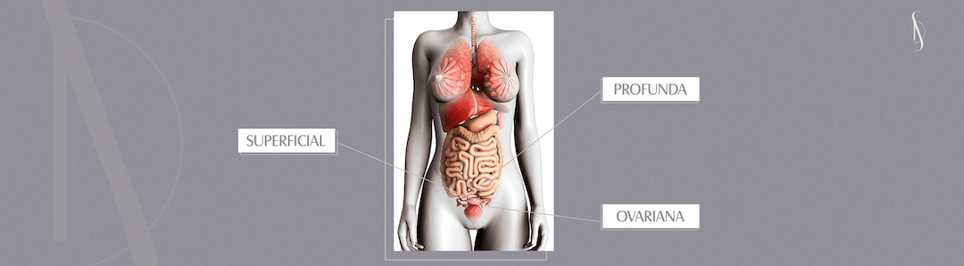 dr-stenio-deslandes-endometriose-doenca-min